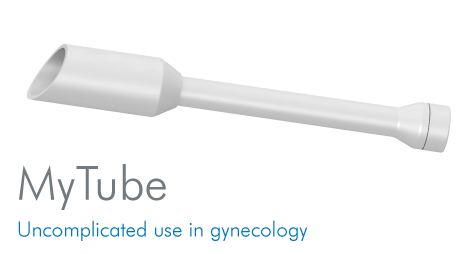 MyTube - uncomplicated use in gynecology